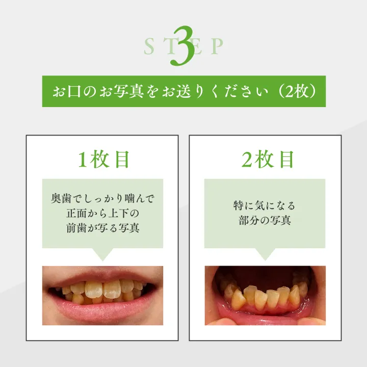 LINEでお問い合わせ